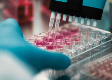 Genetic testing results | close up of researcher working with samples in a lab